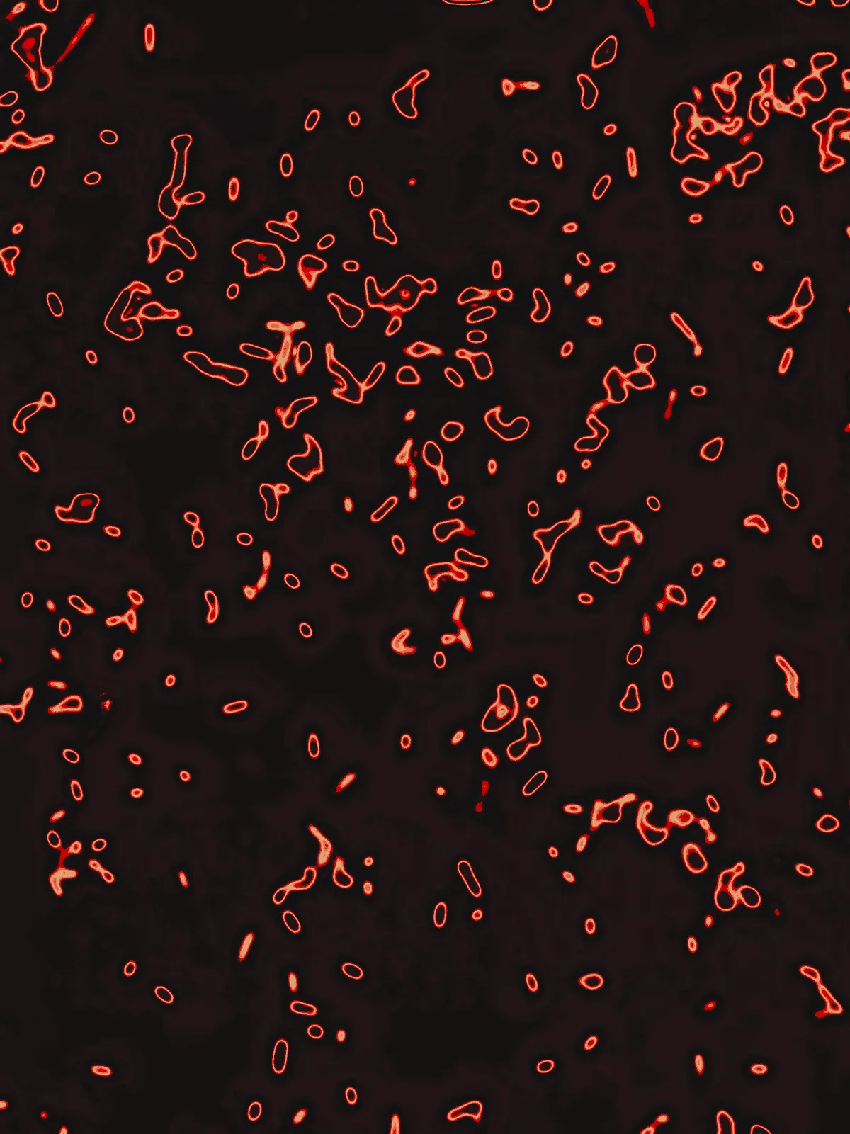 Micro Dysbiotic, 2023
